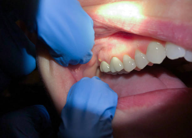 Best Broken or Chipped Tooth Repair in Waldo, FL